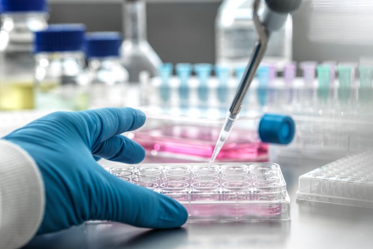 Scientist pipetting medical samples into microplate in laboratory